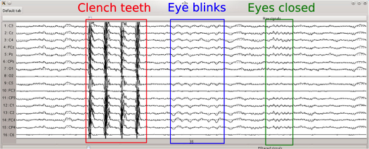 EEG Noise Example